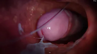 China Twink XXX Tube 12